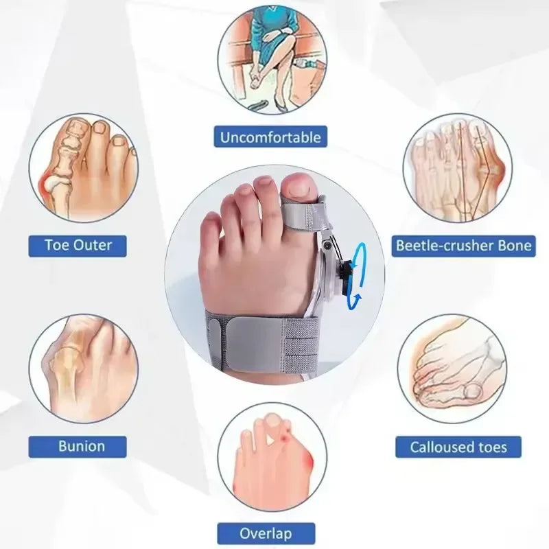 Bunion Corrector Unisex Foot Hallux Valgus Braces Rotatable Toe Separator Straightener Adjustable Pedicure Finger Toe Corrector Velt UK | SALE